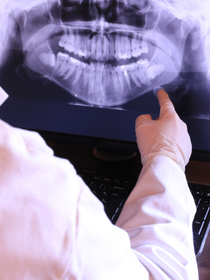 Dental Xrays Markham Dentist