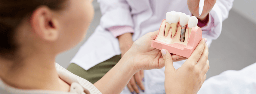 Dental Implants in Markham and Unionville